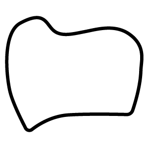Porcelain Buccal Margin